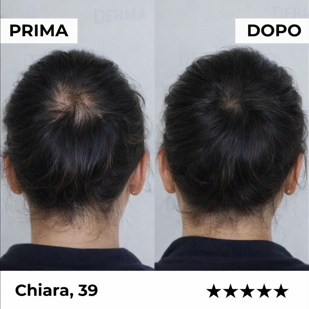 Sistema di microinfusione Firmelià Donne