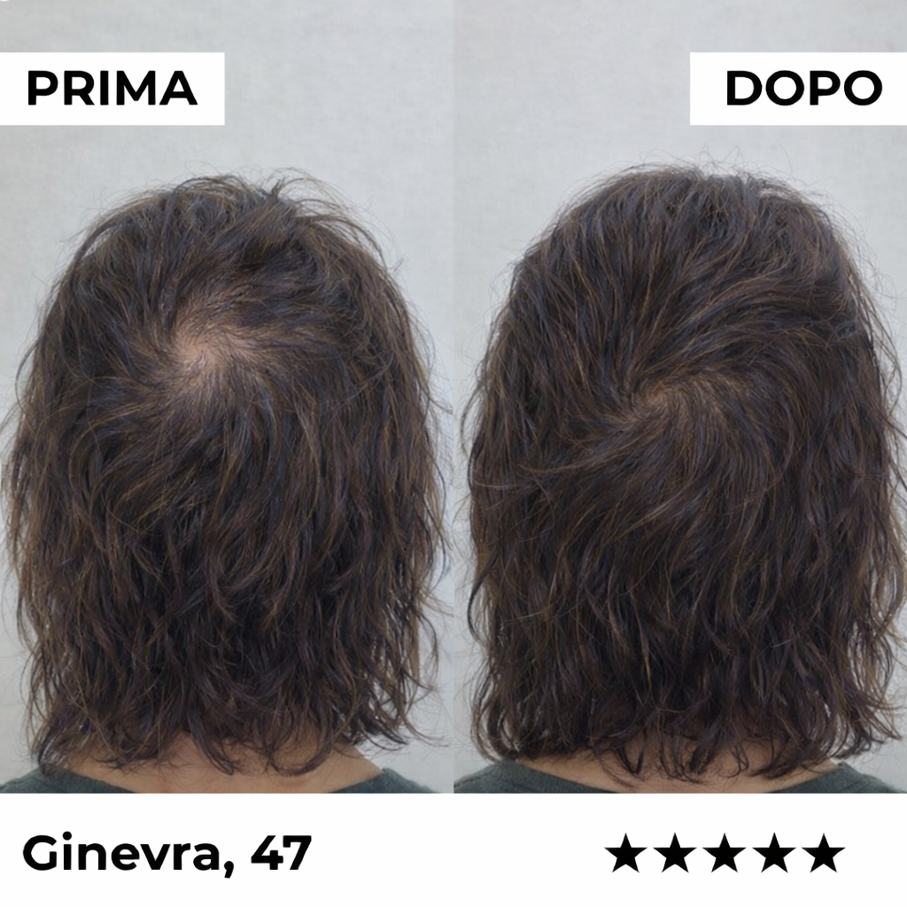 Sistema di microinfusione Firmelià Donne