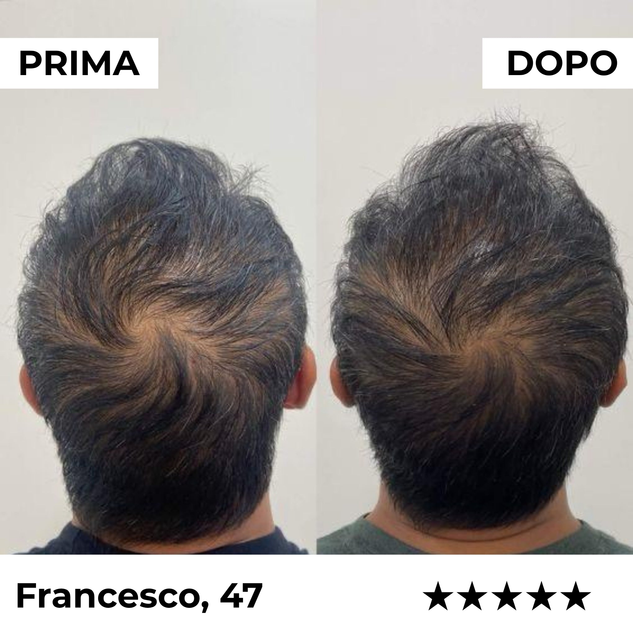 Sistema di Microinfusione Firmelià Uomo