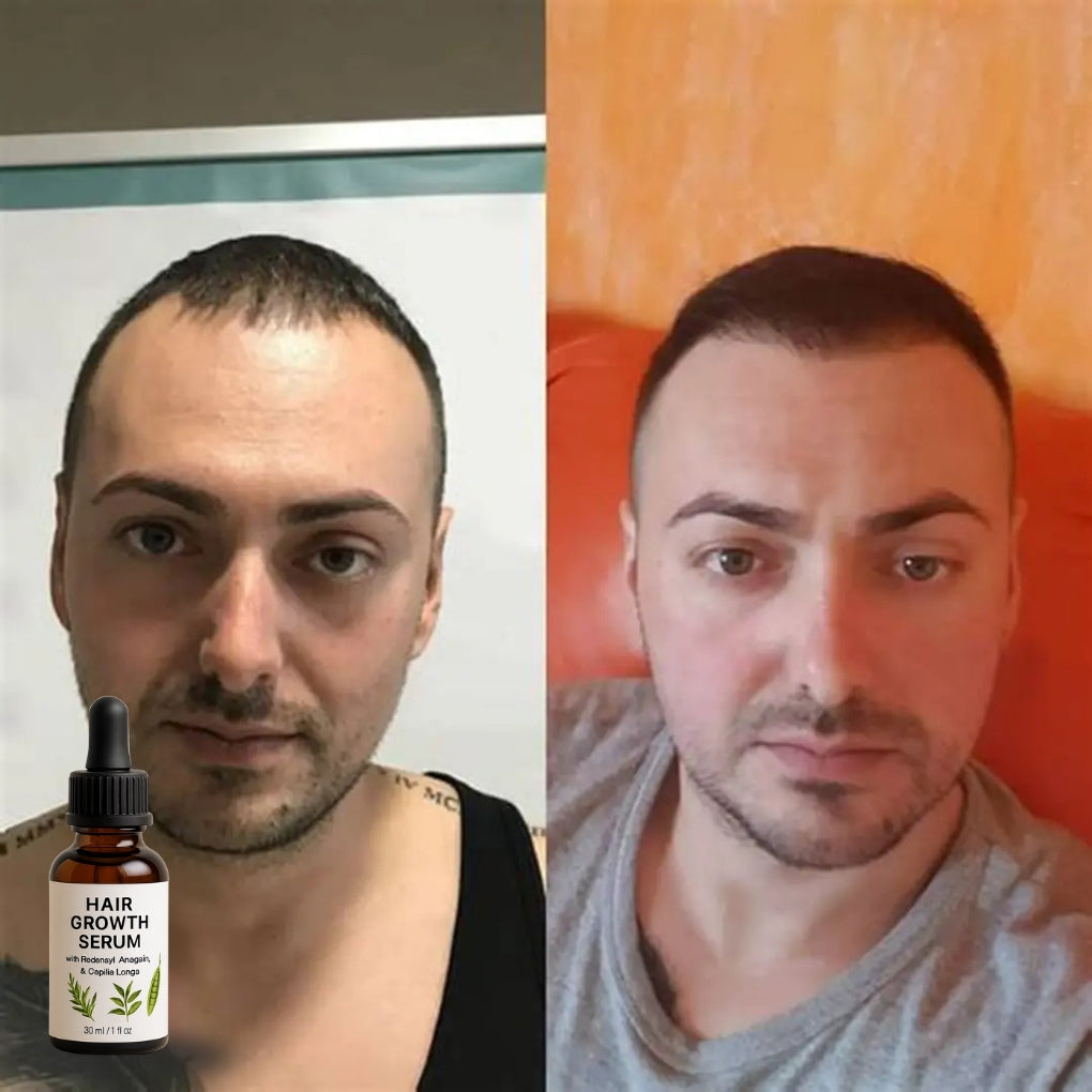 Firmelià Siero Post-Trattamento