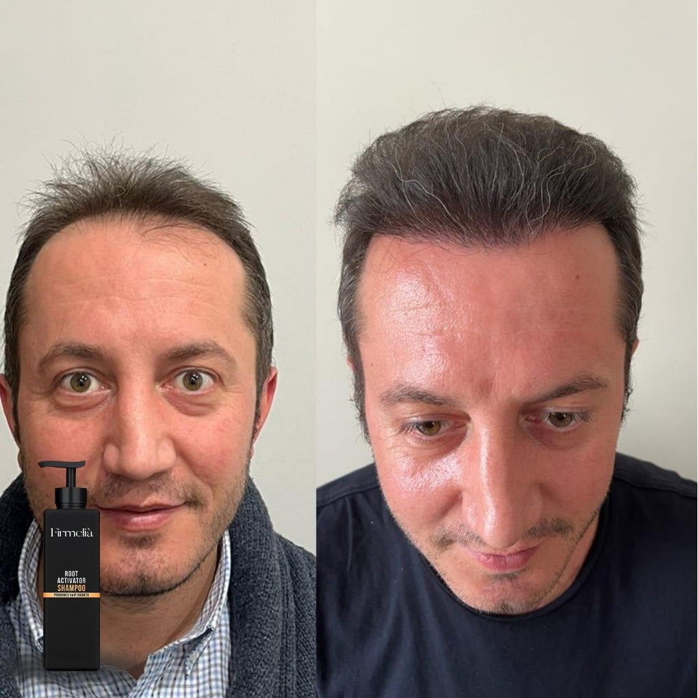 Firmelià Shampoo